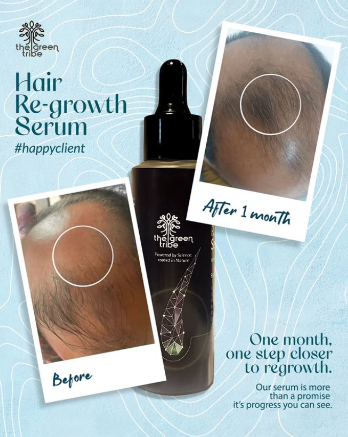 Hair Re Growth Serum